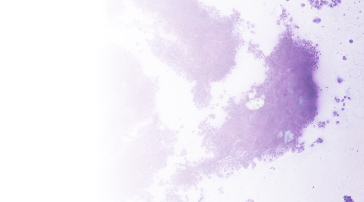 fine needle aspirate cells