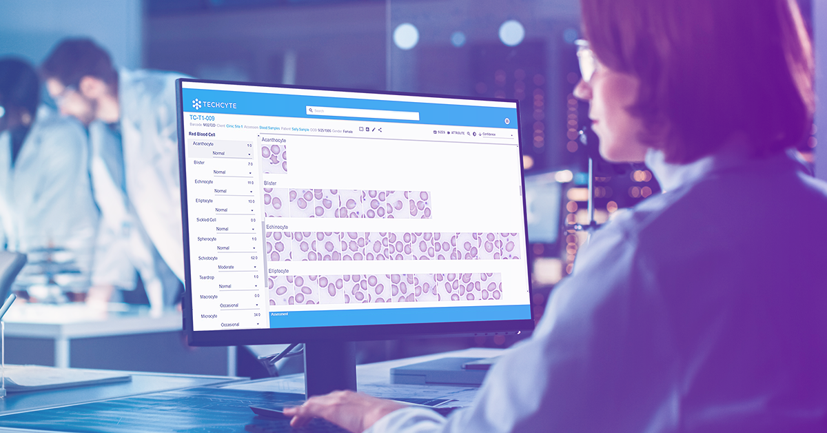 Techcyte Improves Digital Diagnostic Workflows for Clinical Pathology