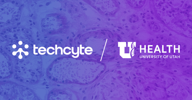 New Study by The University of Utah and Techcyte Demonstrates the Value of AI in Organ Transplantation
