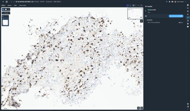 Techcyte Fusion Aiforia